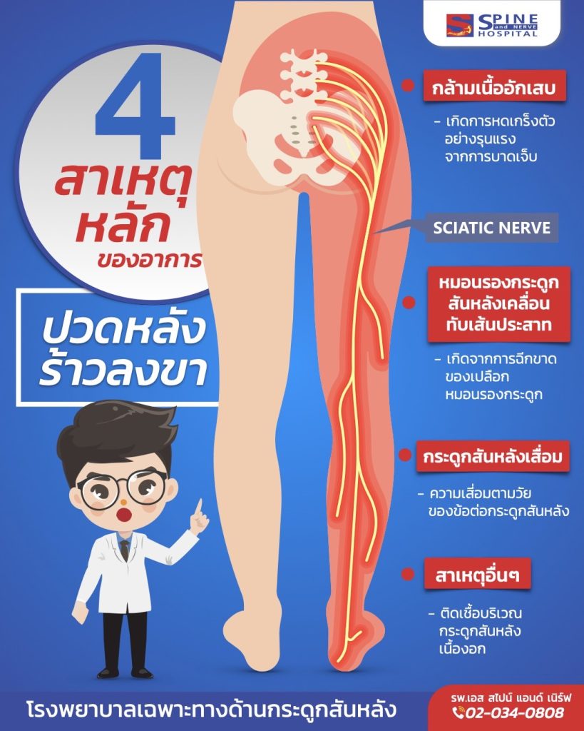 สาเหตุของอาการปวดหลังร้าวลงขา