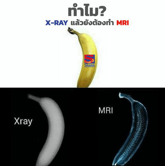 ความแตกต่างระหว่าง X-ray และ MRI