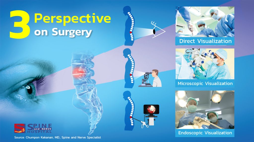 perspective on surgery