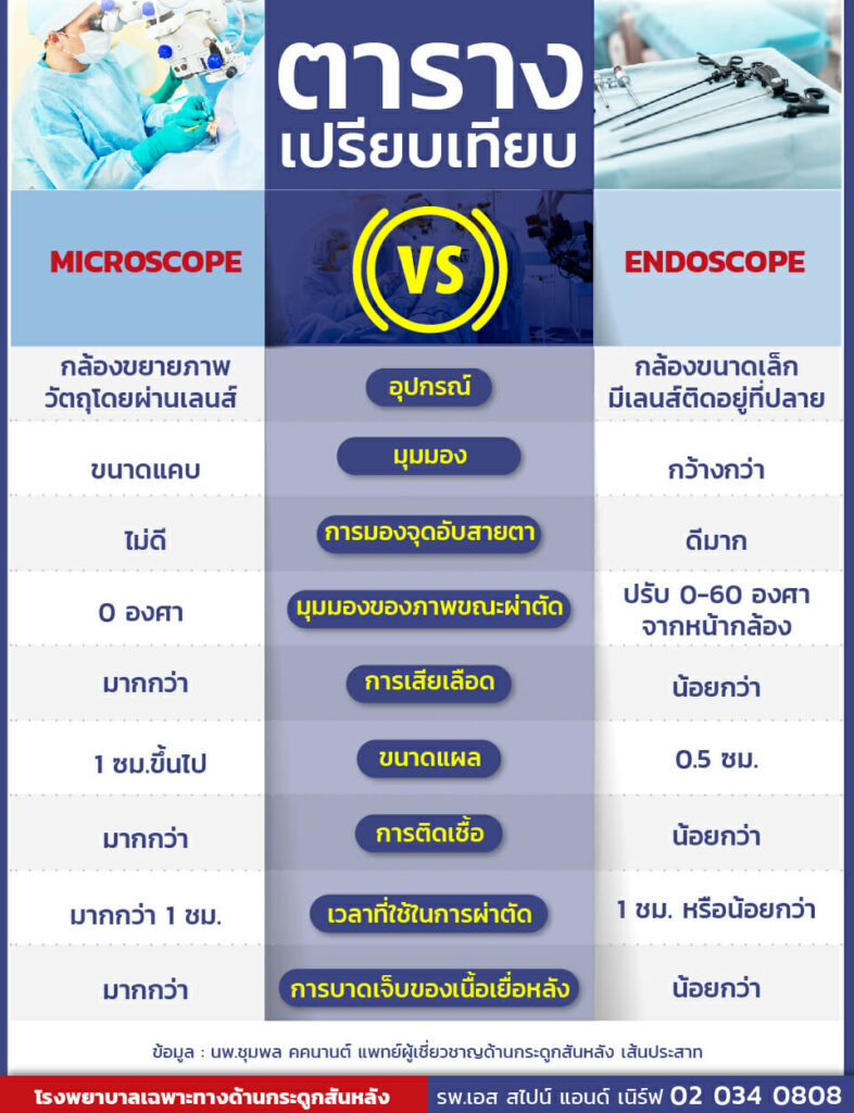 ตารางเปรียบเทียบกล้องผ่าตัดระหว่าง กล้อง Microscope และ กล้อง Endoscope