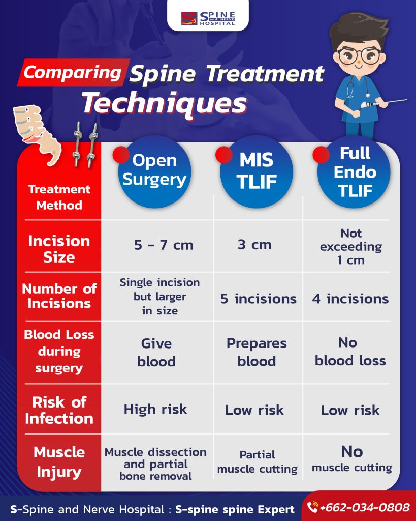 info comparing spine treatment techniques